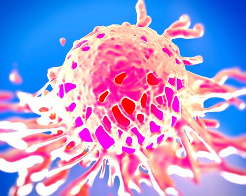 combattre le cancer grâce à l'intelligence artificielle